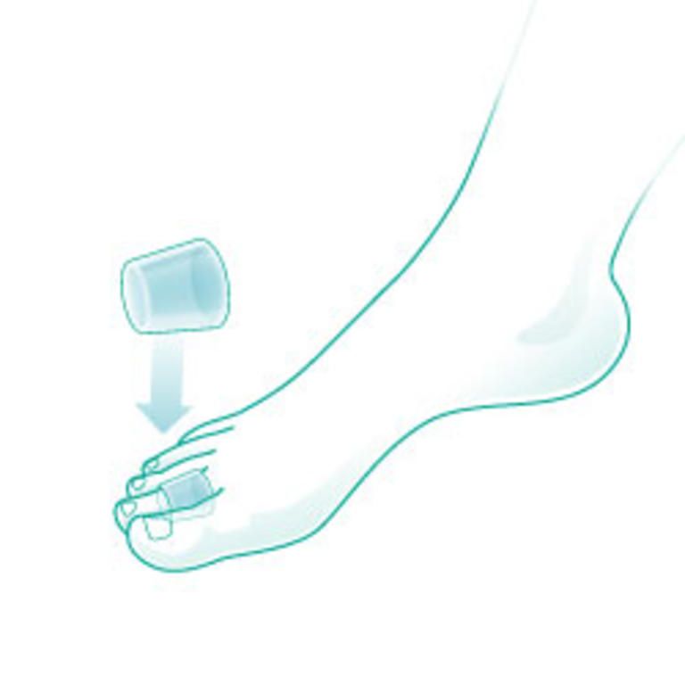 Гелевая подкладка 6720 OPPO Medical для пальцев стопы от натирания, 2шт купить в OrtoMir24